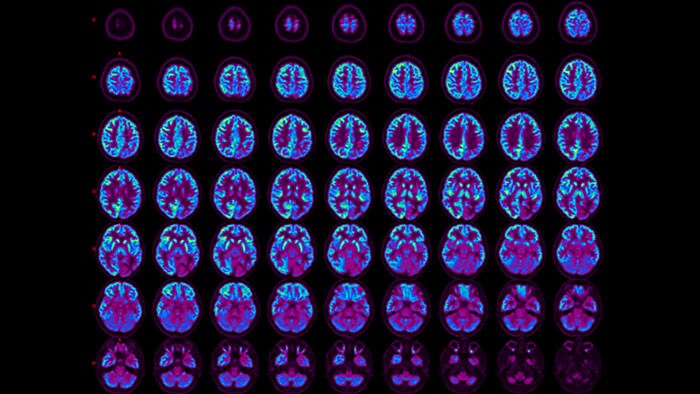 NeuroQ 3.75 thumbnail