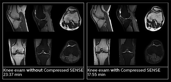 magnetic resonance for the ED