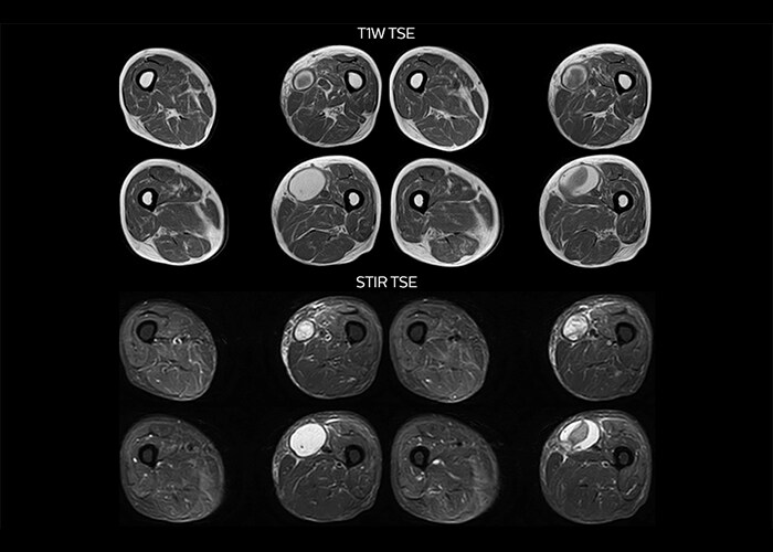 clinical cases tab1 image2