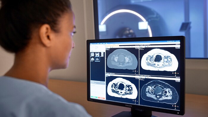 MRI in RT planning 