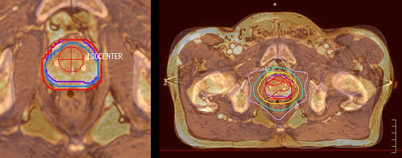 fieldstrength ingenia clinical case 2 3