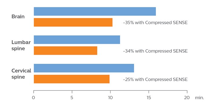 Reduction of scanning time with Compressed SENSE