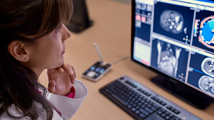 doctor is looking radiology MRI