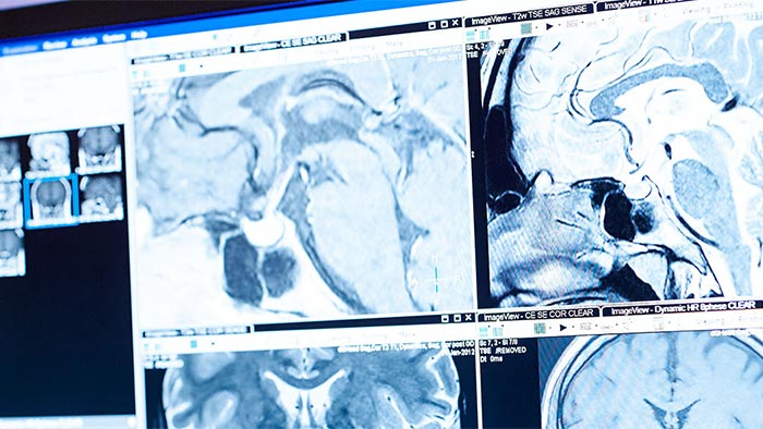 Philips product innovations