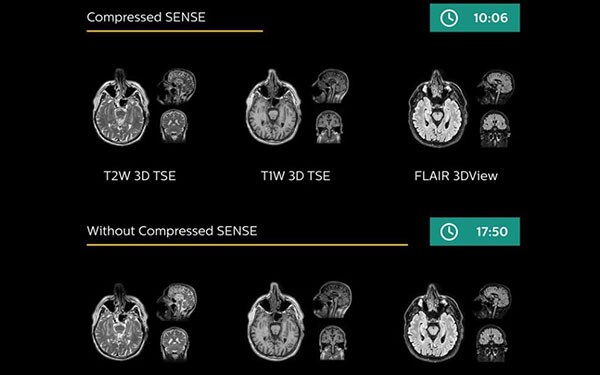 compressed sense