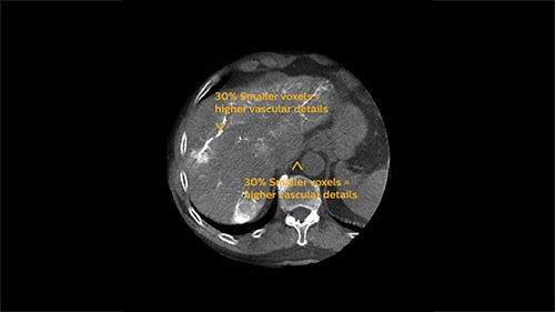 assess clinical image phase