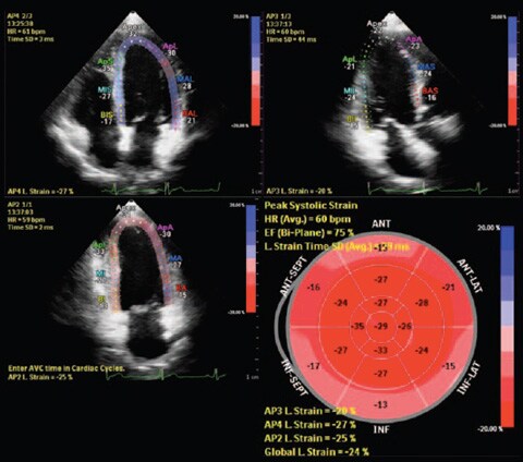 ultrasound image