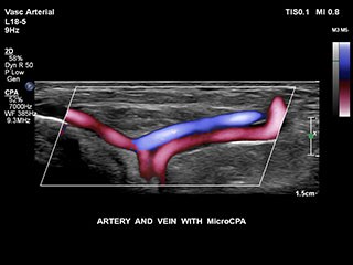 vascular and veins image